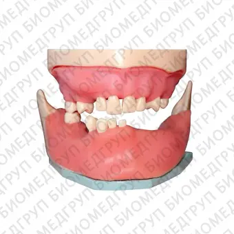 МУ0363  дентомодель для хирургической практики