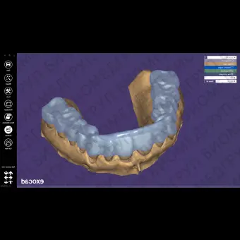 Exocad Bite Splint Module  модуль для создания терапевтических капп