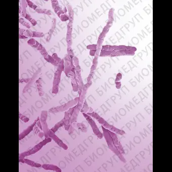 Clostridium perfringens