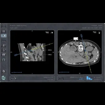 Система биопсии печени IMACTIS CTNAVIGATION
