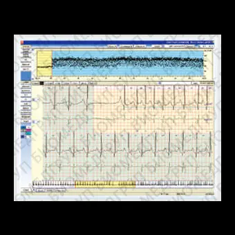 Медицинское программное обеспечение Cardy Analyzer05