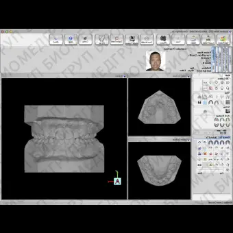 Программное обеспечение для стоматологических лабoраторий Ortho Insight 3D Full / Lite