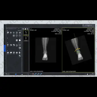 Программное обеспечение рентгенографии VXvue with PureImpact