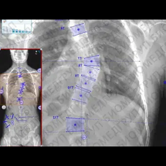 Медицинское программное обеспечение OrthoView