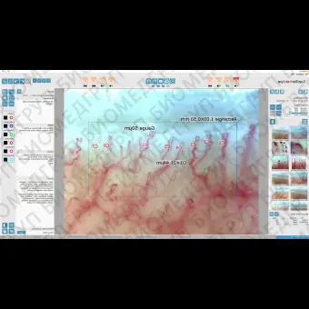 Капилляроскоп видео DM04