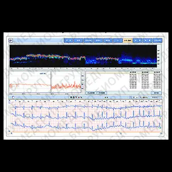 Медицинское программное обеспечение AFib Detection