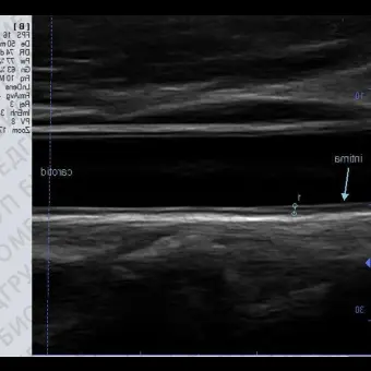 Ультразвуковой сканер на платформе C200