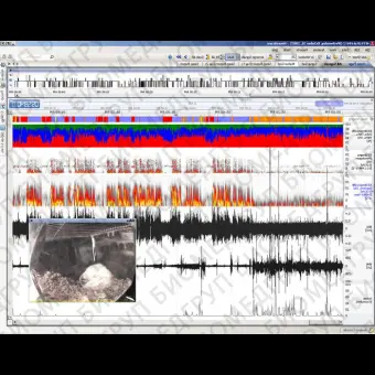 Программное обеспечение для нейрофизиологического стимулирования NeuroScore