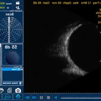 Accutome by Keeler Bscan Plus Ультразвуковое оборудование