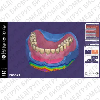 Exocad Full Denture Module  модуль для создания полносъемных протезов