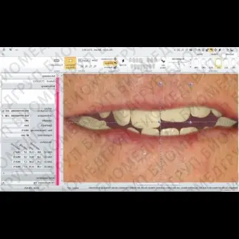 Программное обеспечение для стоматологических лабoраторий VITA ShadeAssist, VITA ToothConfigurator