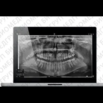 Программное обеспечение для обработки снимков зубов CS Imaging version 8