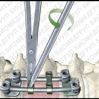 Пластина скоба XIA anterior, с двумя отверстиями, каудальная, средняя