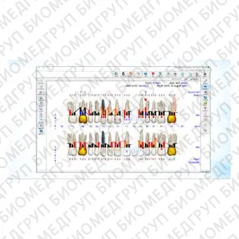 Программное обеспечение для стоматологии FP32