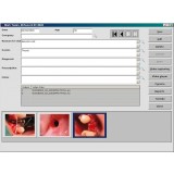 Модуль программного обеспечения для обработки снимков зубов Digitally Soft