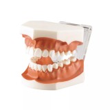 TOOTH MODEL G-TYPE - фантомная челюсть с несъемными зубами