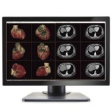 Double Black Imaging Image Systems Gemini 6MP Large Format Display Медицинский монитор