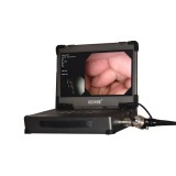 Видеопроцессор для эндоскопии